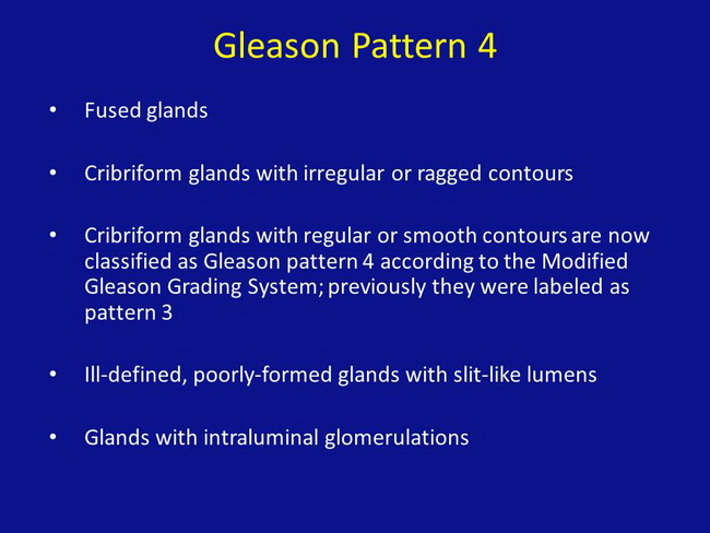 Gleason Pattern 4_Resized.jpg